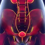 Bladder cancer - Symptoms, causes and More