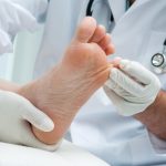 Athlete's Foot Treatment, Causes & Symptoms